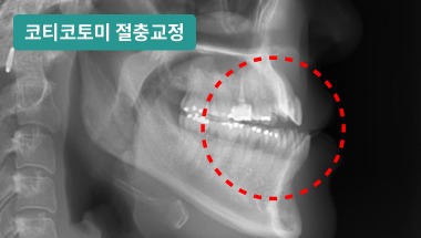 컬럼 썸네일 부분