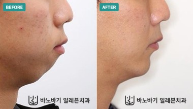 컬럼 썸네일 부분