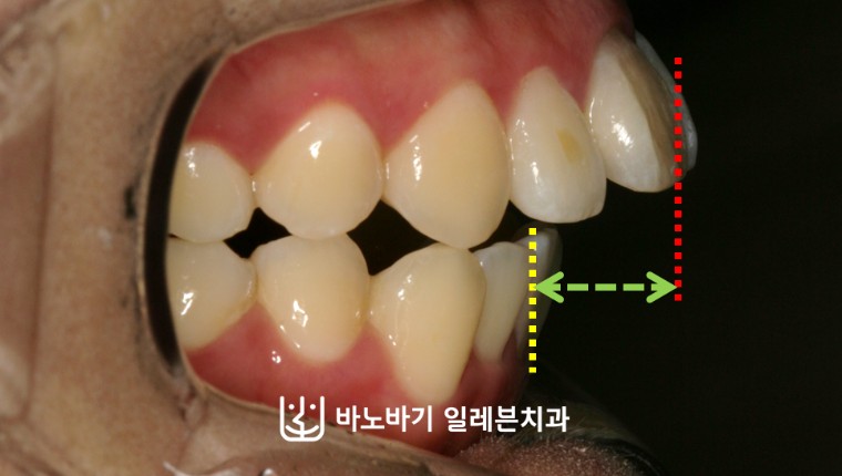 컬럼 썸네일 부분