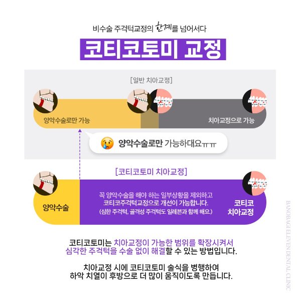 코티코토미 교정, 일반 치아교정과 코티코 치아교정의 치료 가능 범위 비교