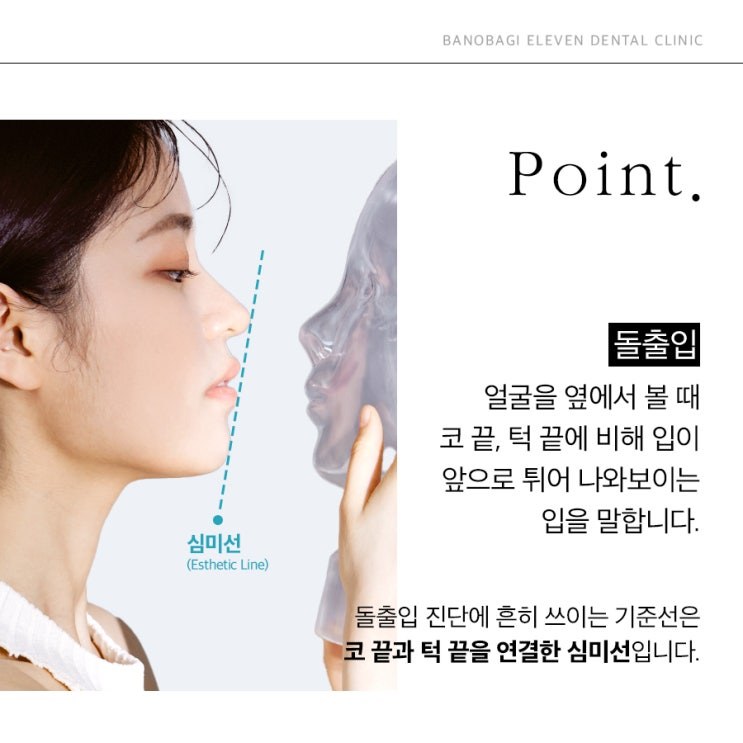 돌출입 진단 기준, 코끝과 턱끝을 연결한 심미선
