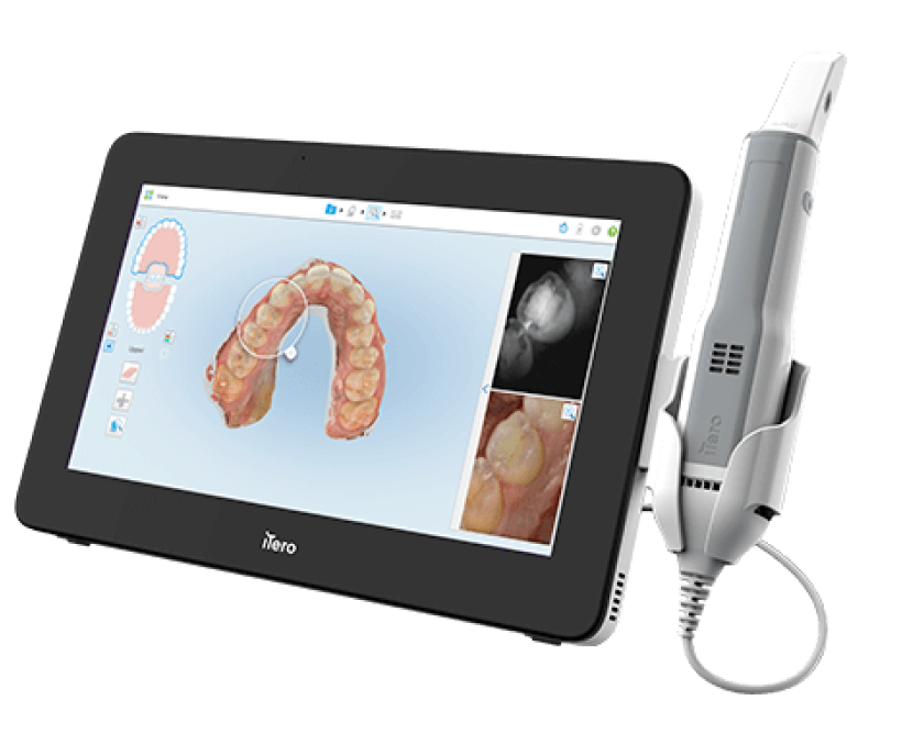 iTero Element 5D Plus - 첨단 광학 스캐너